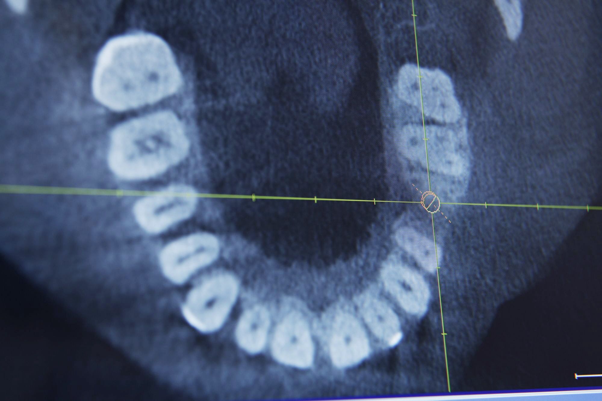 MKG Praxis Dr. Dr. R. Wörtche Leistungen